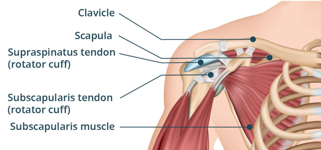 rotatorcuff tears