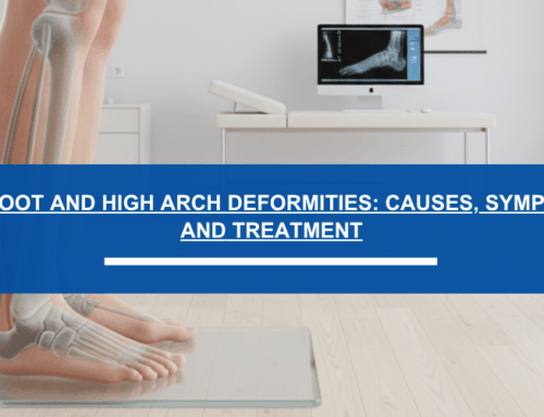Flatfoot and High Arch Deformities: Causes, Symptoms, and How to Treat Them