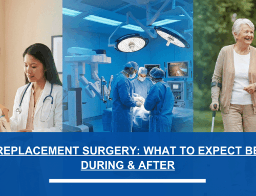 Knee Replacement Surgery: What to Expect Before, During & After